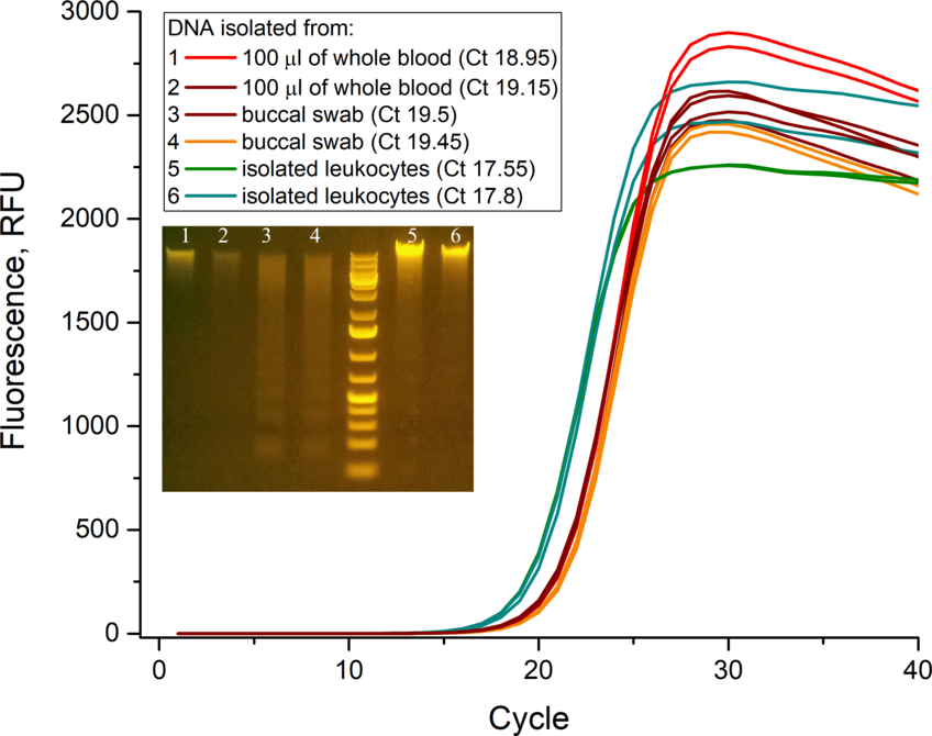 Кривые амплификации фрагмента гена бета-актина человека.<br />В качестве матрицы для ПЦР в реальном времени были использованы образцы геномной ДНК, выделенные из цельной крови (1,2), соскоба буккального эпителия (3,4) и лейкоцитов (5,6) (указаны пороговые циклы (Ct) и приведена электрфореграмма исходных образцов ДНК). Размер амплифицируемого фрагмента 250 пн, ПЦР в реальном времени проводили с использованием интеркалирующего красителя <a href="/p/sybrgreen-realtime-pcr">SYBR Green I</a> (Lumiprobe). Маркер длин ДНК 1 Kb Plus DNA Ladder (Thermo Fisher Scientific), верхняя полоса 20 000 пн.